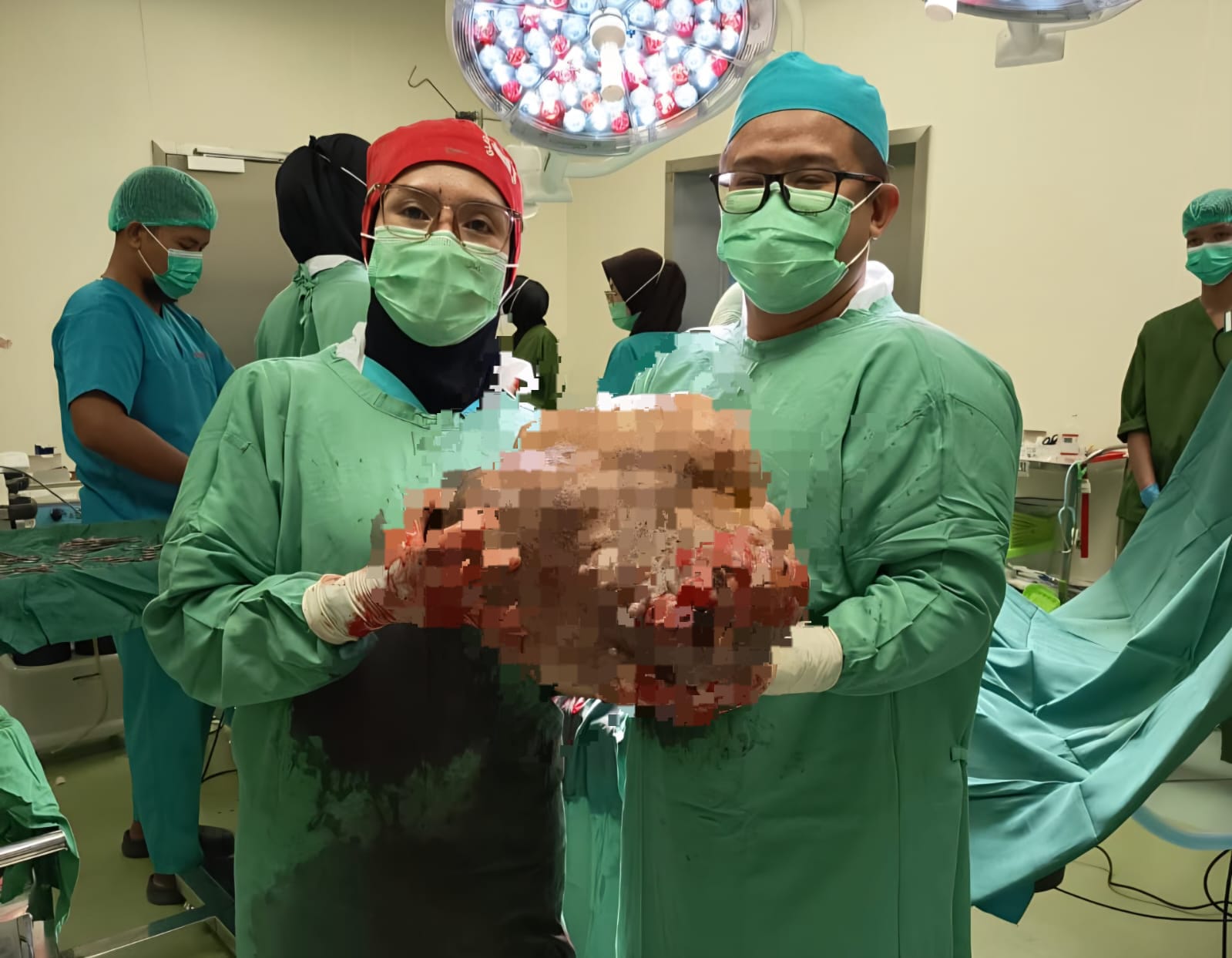 Tim dokter RS Idaman Banjarbaru memperlihatkan tumor dengan berat 13 kg setelah berhasil dioperasi (Prokopim untuk Radar Banjarmasin)
