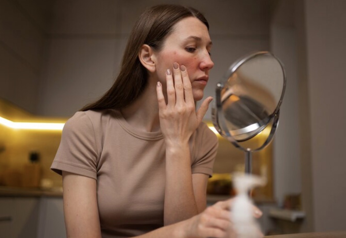 RUSAK: Skin barrier juga bisa terganggu karena kebiasaan sepele yang tak disadari. (Foto: Freepik)