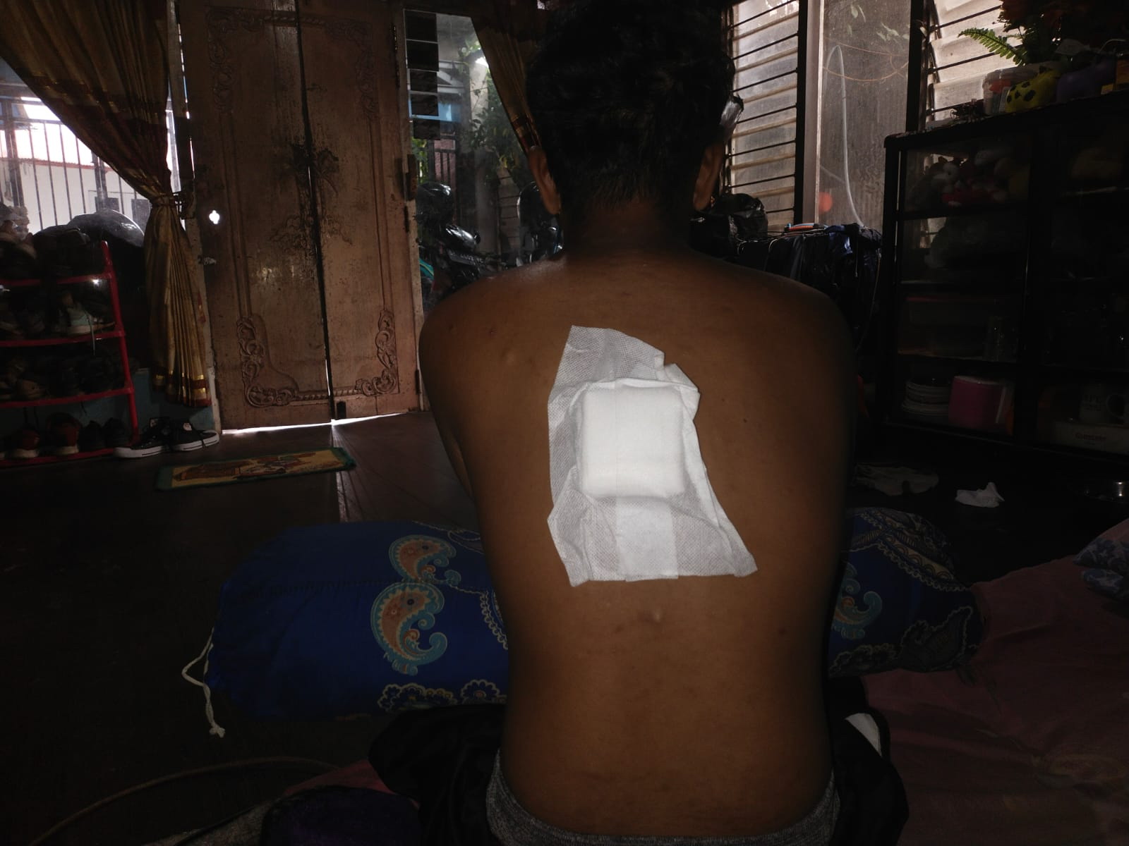 MASIH PEMULIHAN: Siswa SMAN 9 Banjarmasin Ady Mufadhdhol yang mengalami pengeroyokan saat bekerja.