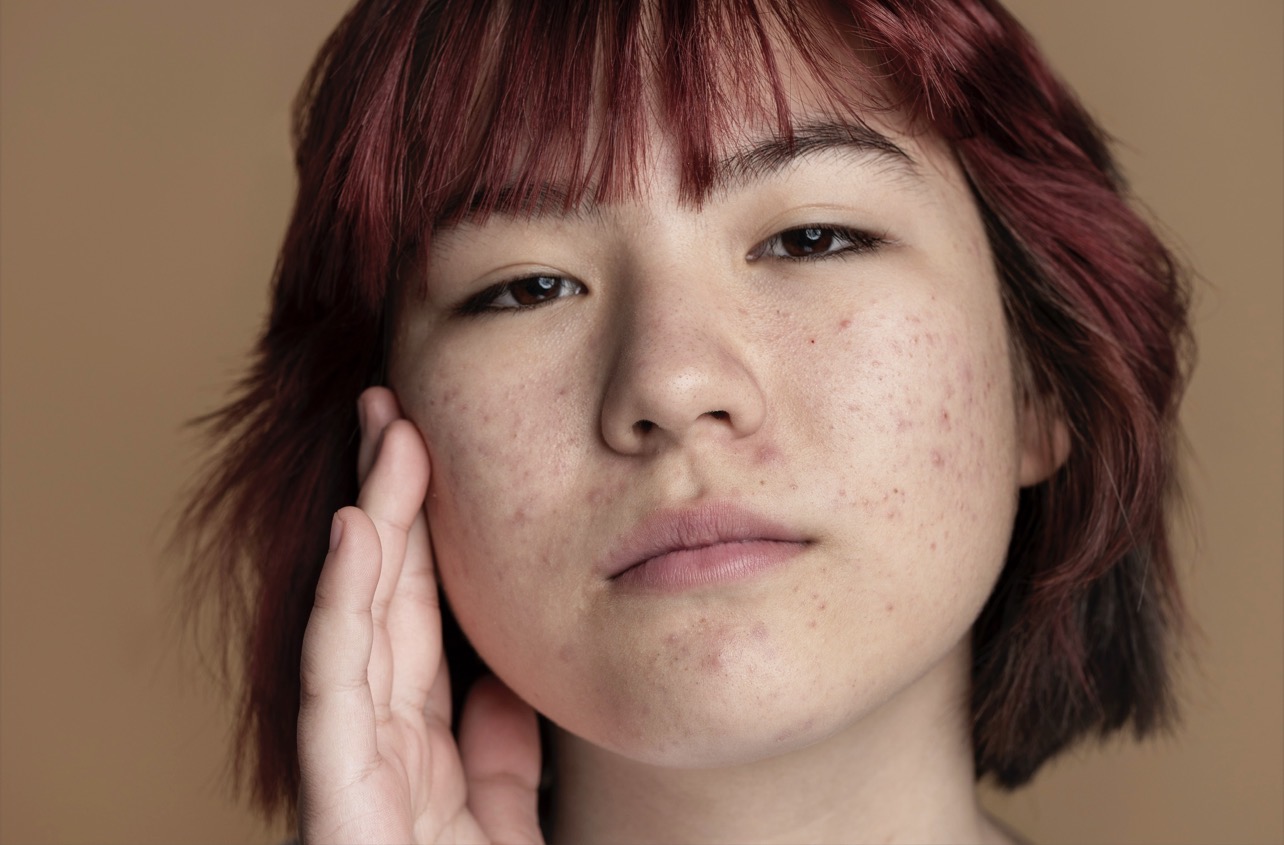 HALUS: Merias wajah yang bruntusan butuh trik khusus agar hasilnya halus. (Foto: Freepik)