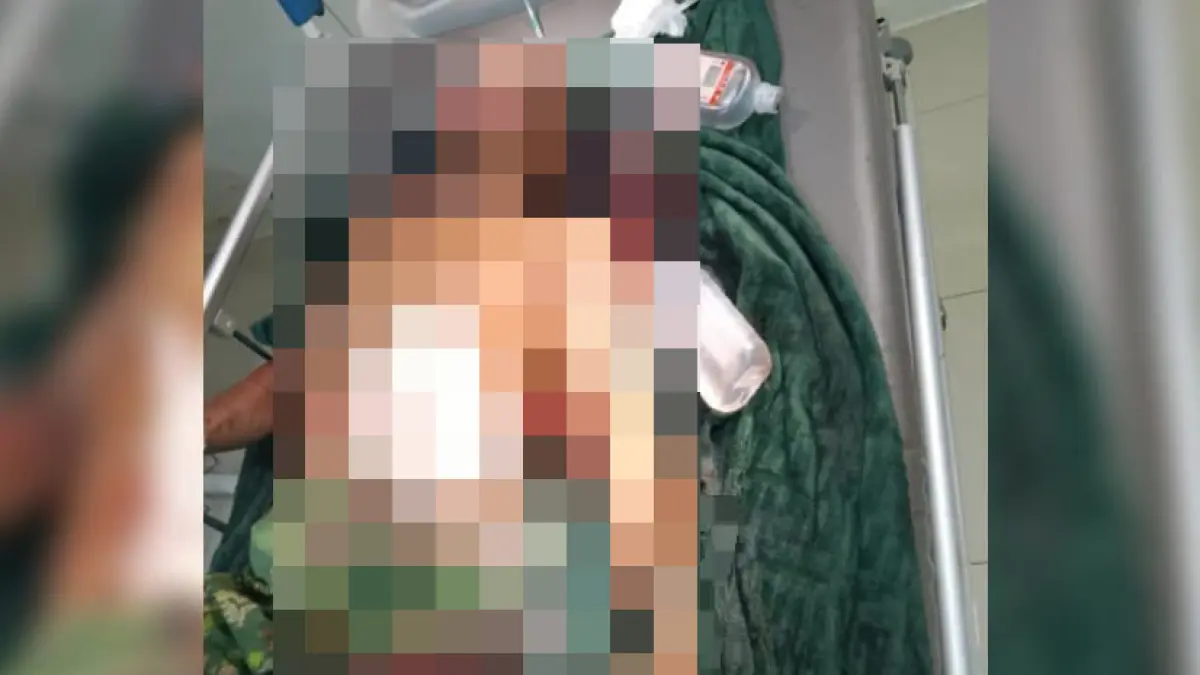 TERBARING: S (53) korban curas di Desa Tajau Pecah, Kecamatan Batu Ampar saat menjalani perawatan di rumah sakit.