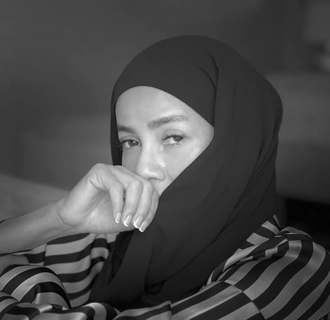 Idap Dermatitis Perioral, Penyebab Olla Ramlan Menuliskan Pesan Minta Tolong