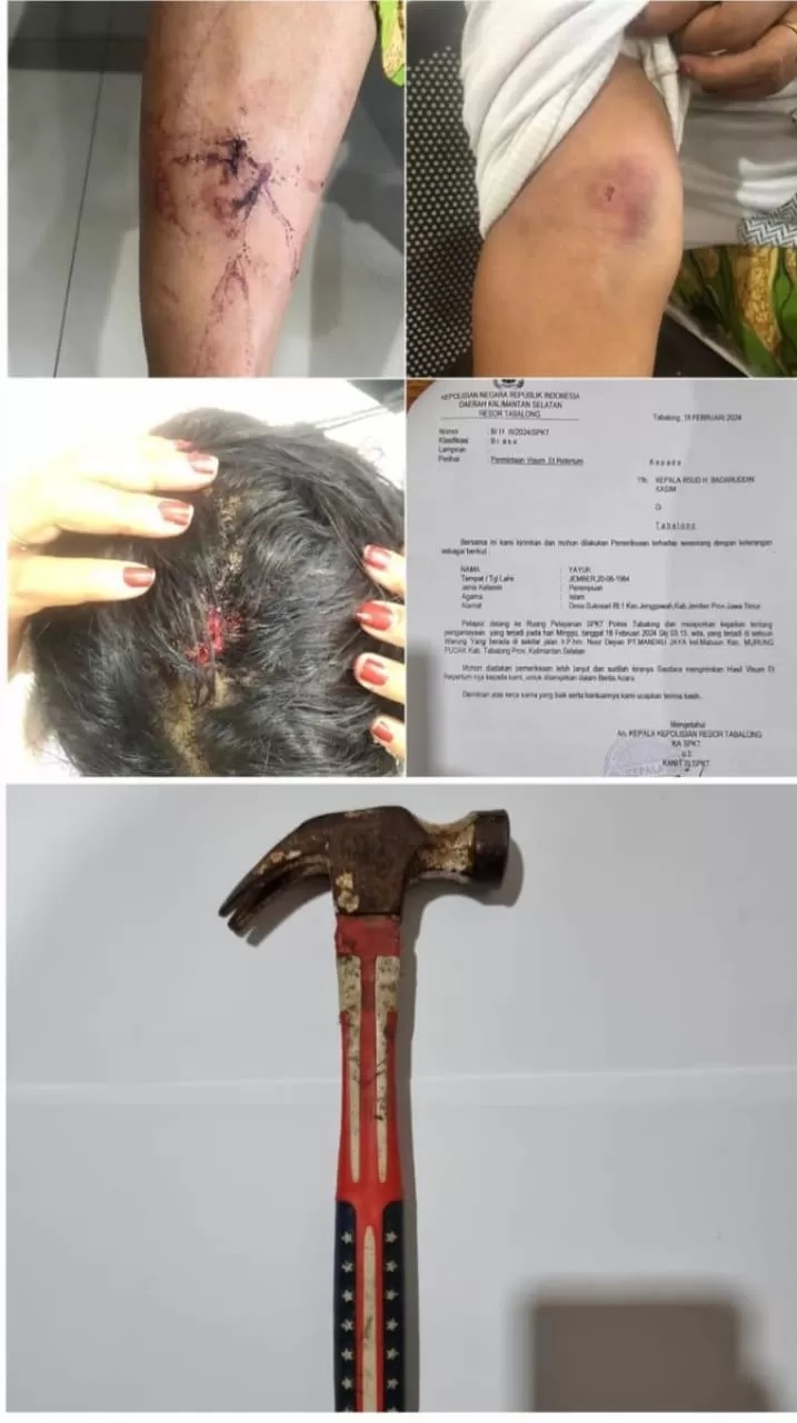 BUKTI: Sejumlah bukti penganiayaan yang dilakukan AS kepada sang kekasih.(foto: Polres Tabalong untuk Radar Banjarmasin)