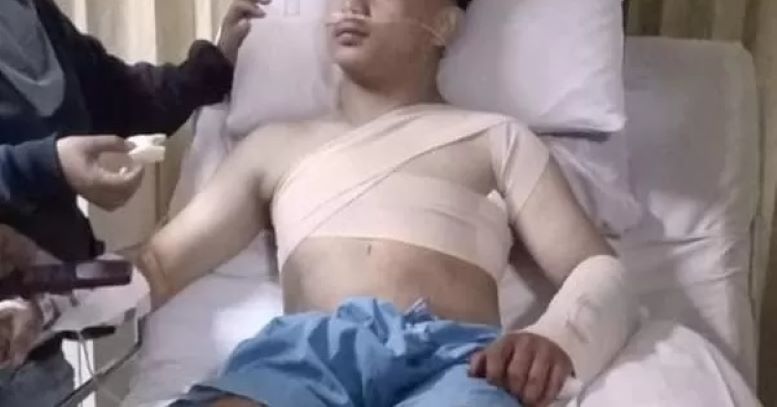 Korban pembacokan orang tak dikenal masih mendapatkan perawatan di RSUD Soedarso Pontianak. Pemuda berusia 18 tahun tersebut mengalami pembacokan pada 24 Februari lalu.