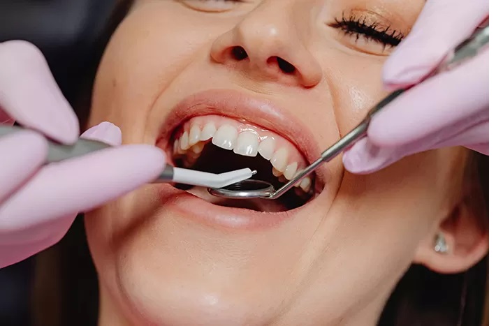 Ilustrasi: periksa gigi. (Pexels/ Karolina Grabowska)