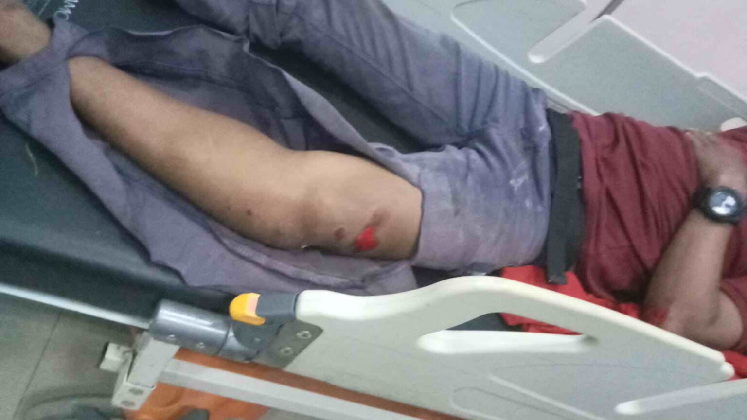 Kecelakaan yang diakibatkan oleh sapi yang berkeliaran kembali terjadi di jalan Pangkalan Bun menuju Kotawaringin Lama, Senin (10/6) pukul 18.45 WIB.