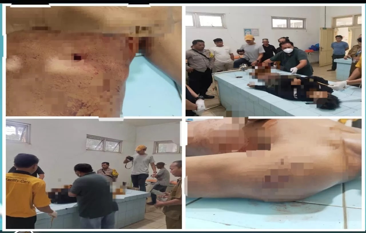 PEMERIKSAAN:Jenazah ABS yang ditemukan di depan Masjid Miftahur Hair Desa Padang Panjang diperiksa di RSUD Ratu Zalecha, terdapat tanda-tanda kekerasan.(Foto:Polres Banjar untuk Radar Banjarmasin)