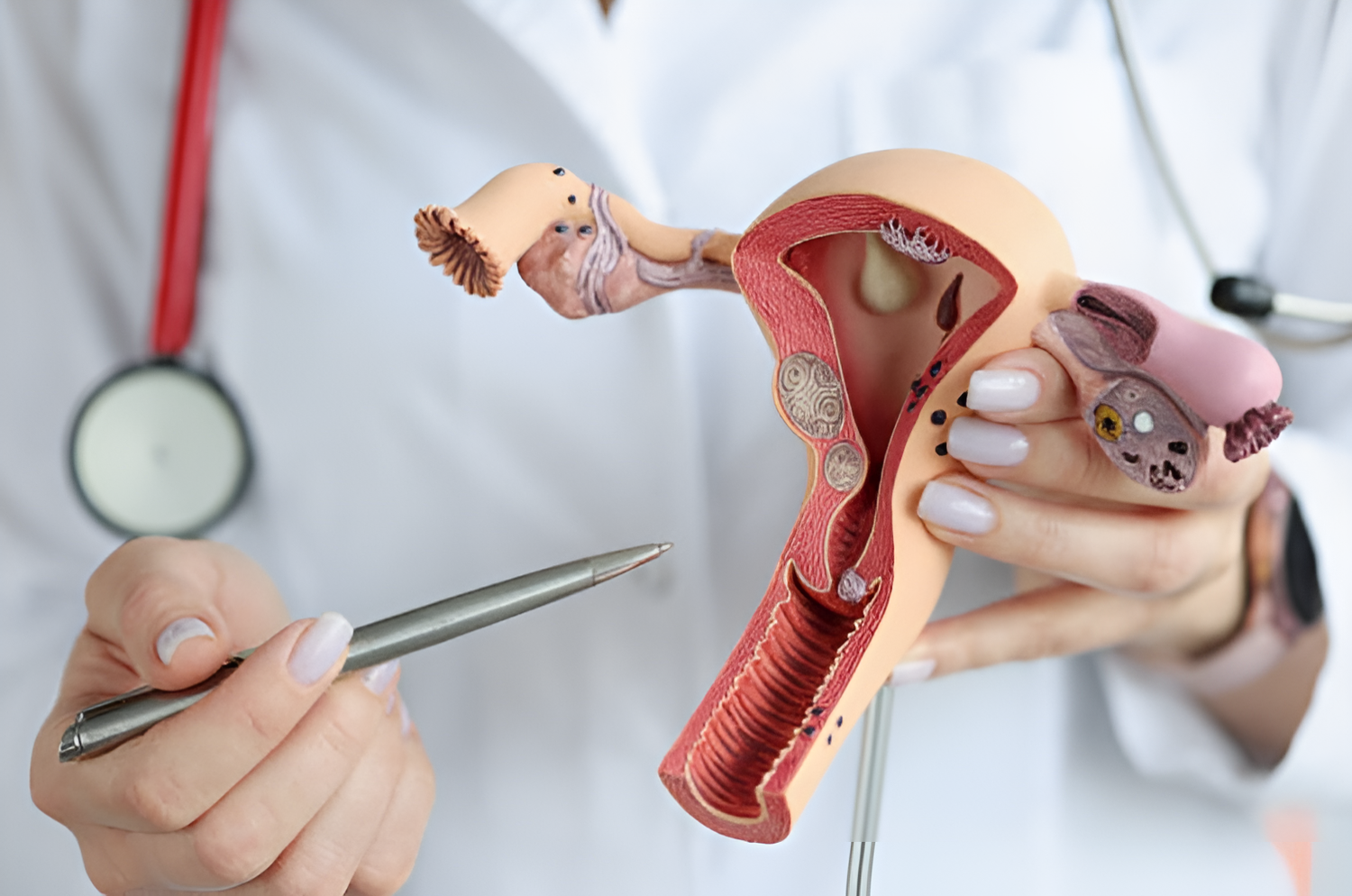 (Foto oleh Ivan-balvan dari iStockphoto)