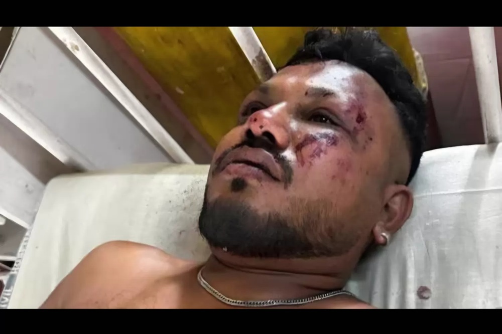 Ramesh Kumar, satu-satunya penumpang pesawat Air India yang dikabarkan selamat.