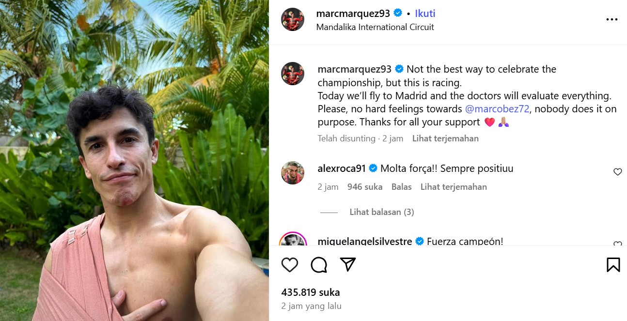 Marc Marquez cedera bahu. (IG)