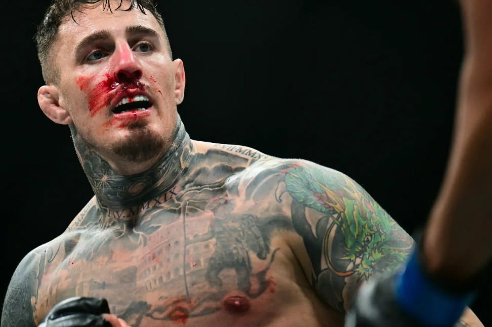 Tom Aspinal berdarah-darah dihajar Ciryl.