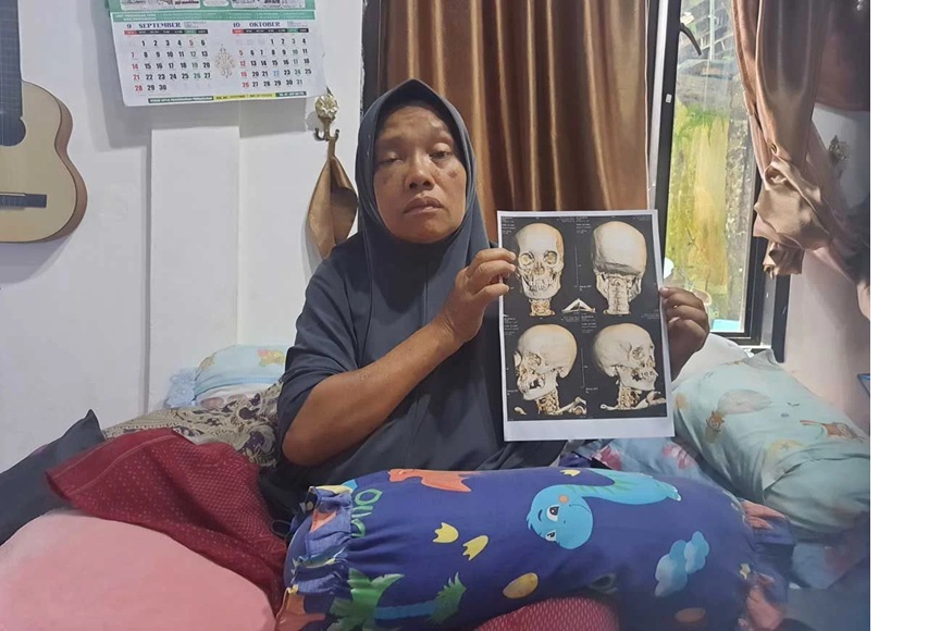 Sri Rohani, Ketua Yayasan Panti Asuhan Annida Qolbu menunjukkan hasil rontgen keretakan tulang pipi dan rahang akibat pemukulan, Jumat (14/11).