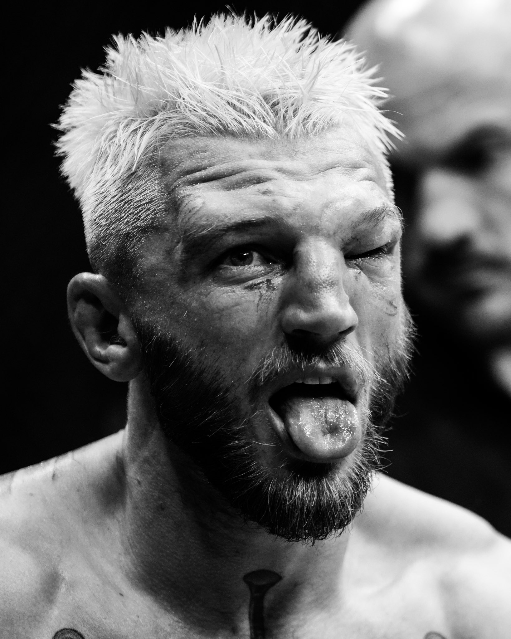 Wajah Dan Hooker saat bertarung dengan Arman Tsarukyan di UFC Qatar (23/11/2025). (X)