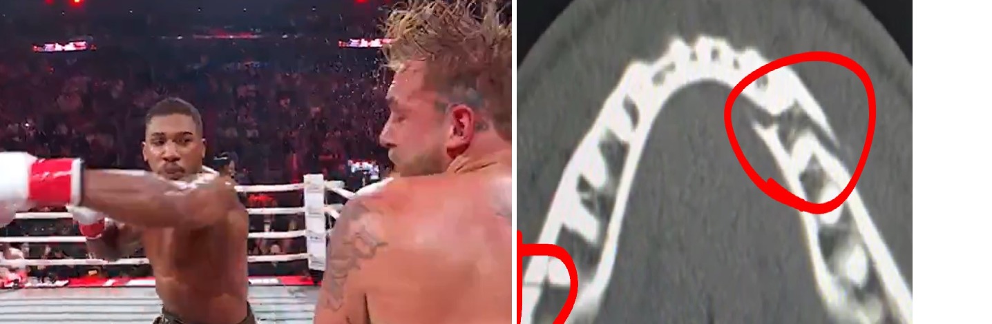 Joshua memukul KO Jake Paul. Rontgen rahang Jake yang patah (foto kanan).