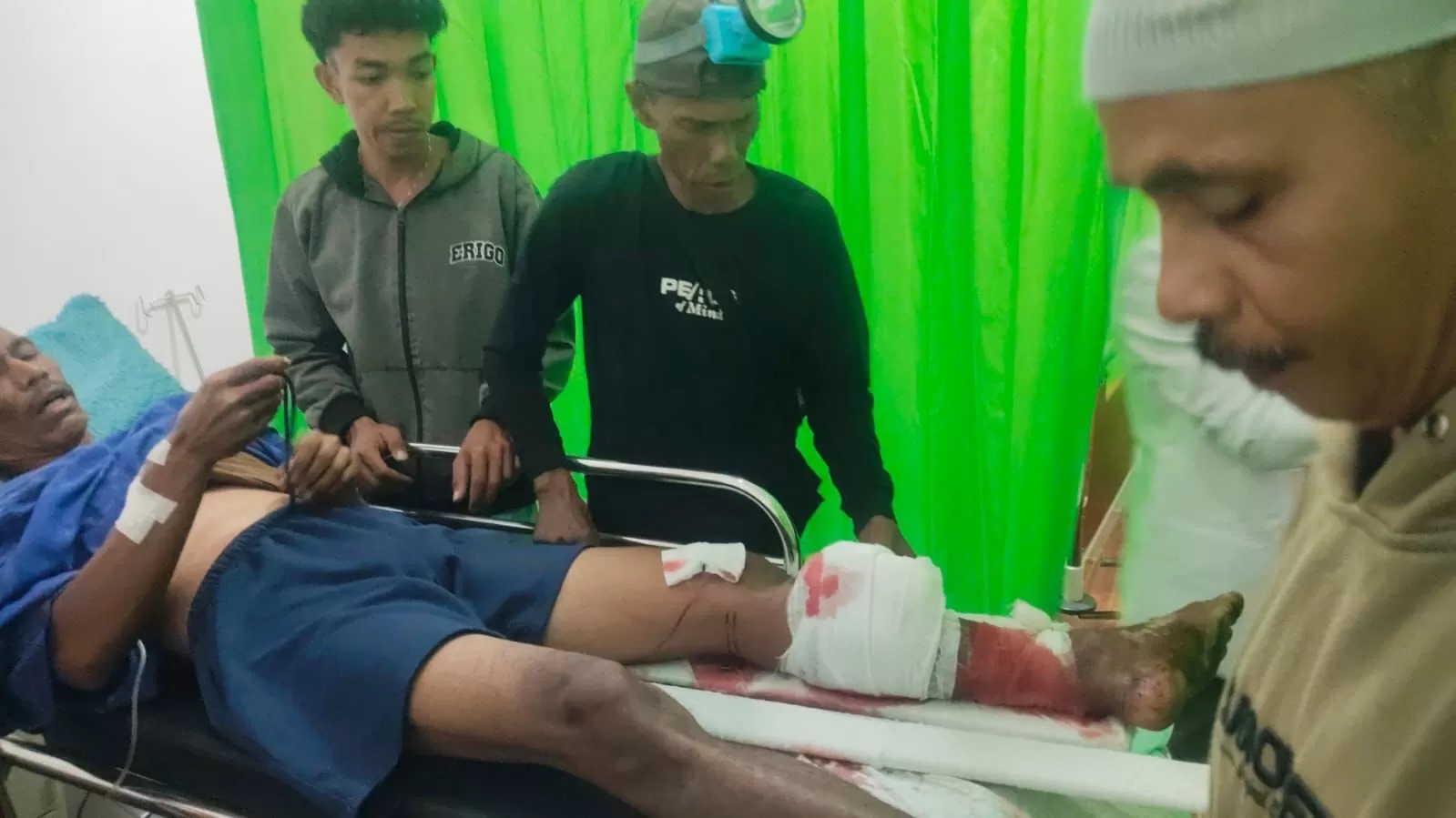 KORBAN BUAYA: Saharuddin sedang dirawat setelah disambar buaya ganas di Desa Pantai Kecamatan Kelumpang Selatan. Foto: Khairul Sani untuk Radar Banjarmasin.