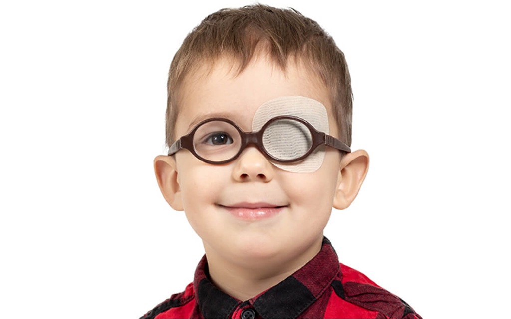 ilustrasi mata malas pada anak.