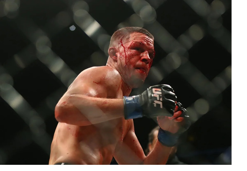 Nate Diaz 