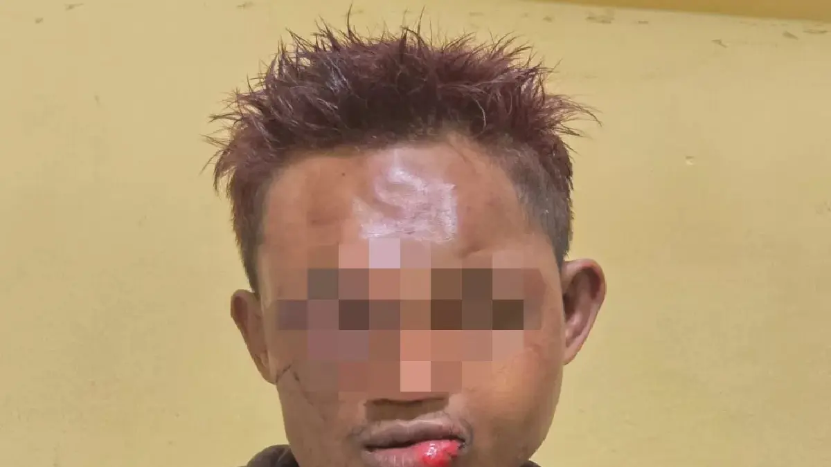 Babak belur usai diamuk massa, terduga pelaku pencurian sepeda motor berinisial AP akhirnya diamankan polisi di wilayah Balikpapan Timur, Jumat (8/5/2026). Polisi bergerak cepat mengevakuasi pelaku.