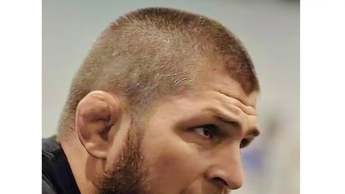 Telinga khas petarung yang berbentuk kembang kol (cauliflower ear), seperti halnya Khabib Nurmagomedov.