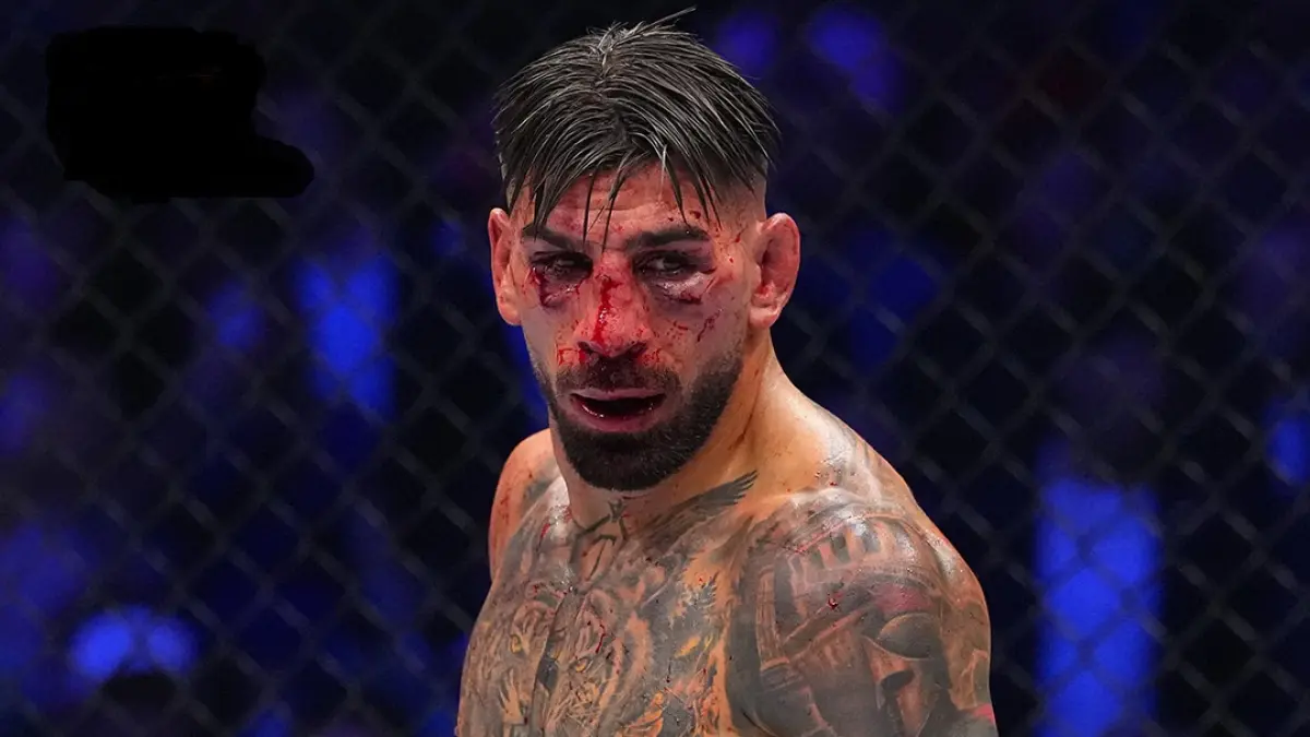 Wajah Ilia bonyok dalam pertarungan dengan Justin Gaethje.