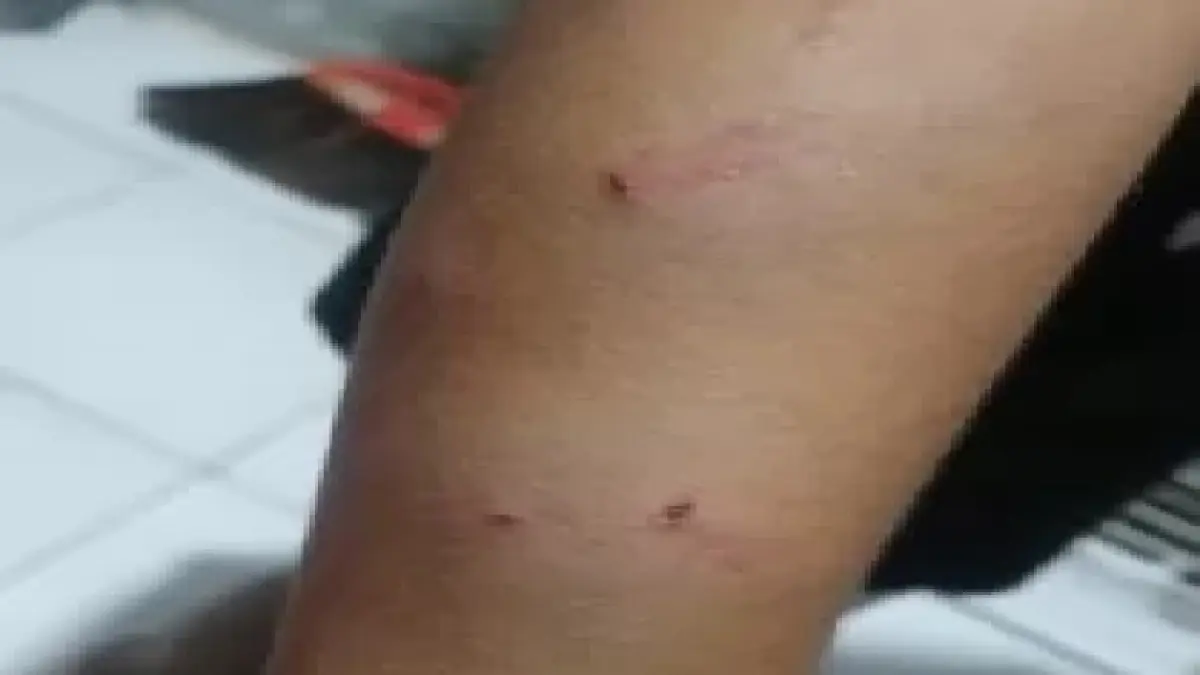 Kondisi korban.