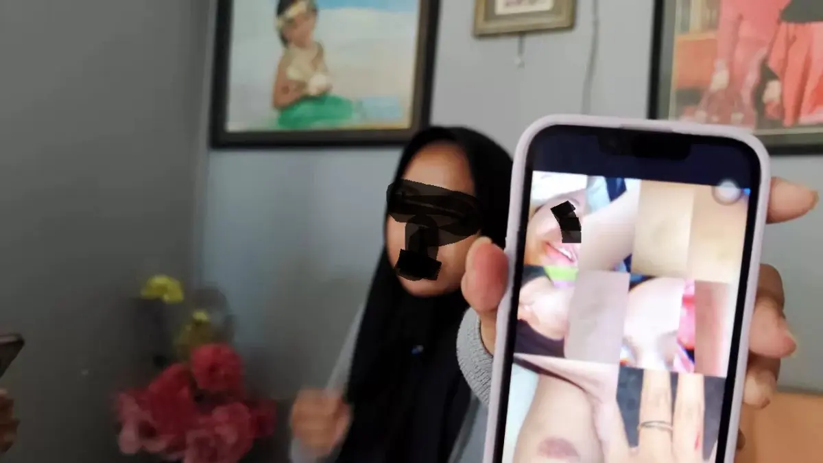 Korban memperlihatkan bukti-bukti luka yang ia alami (ist)