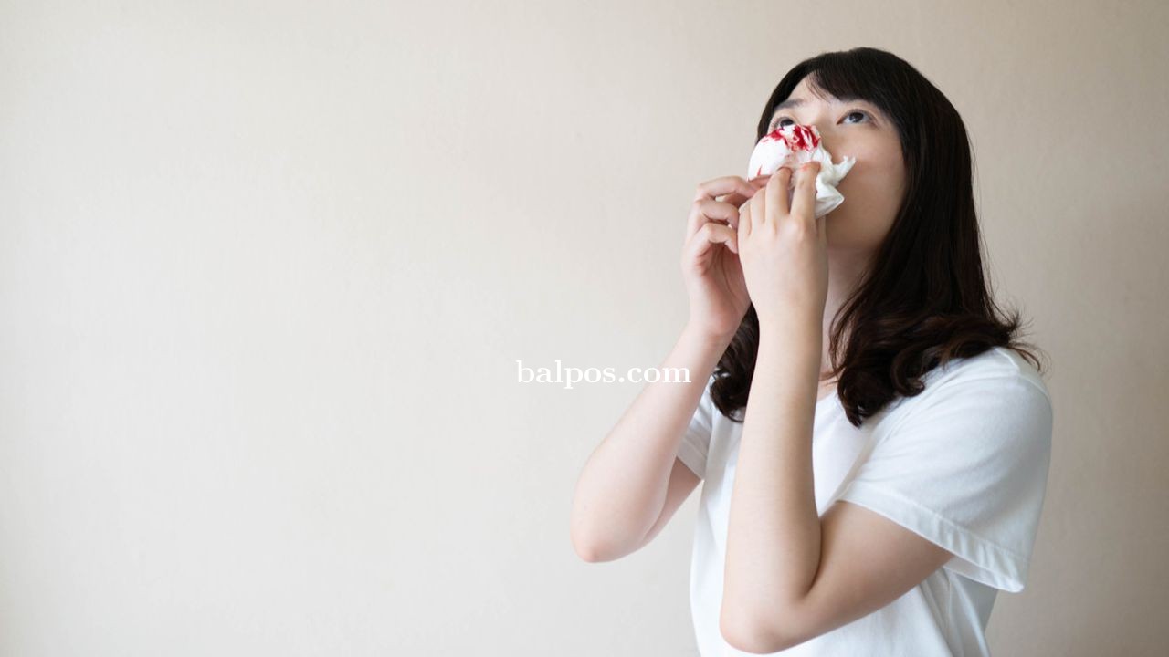 HIDUNG BERDARAH: Jika mimisan berhenti, bisa menyediakan kompres es dan meletakannya di hidung untuk membantu mengencangkan pembuluh darah.