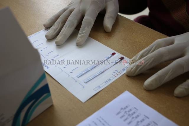 BUKAN ANTIBODI: Sampel darah rapid test antibodi diuji untuk mengidentifikasi potensi terinfeksi Covid-19. Kini, untuk bepergian ke luar daerah dengan transportasi udara tak lagi menggunakan syarat rapid test antibodi melainkan rapid test antigen. | Foto: