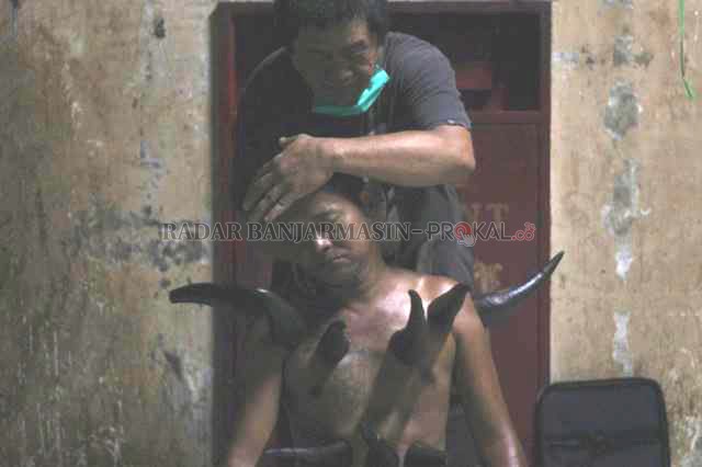 TANDUK SAPI: Rahman memijat kepala Darmadi, sembari tubuhnya dibekam. Sejak peralatan bekam kian modern, penggunaan tanduk sapi kian langka. Kalau mau mencoba, silakan ke Pasar Kasbah.