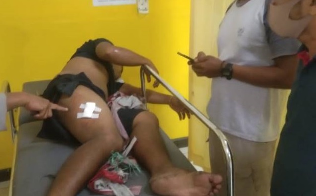 KENA TUSUK: Andi Permana saat dirawat di rumah sakit akibat luka tusuk yang mengenai paha kanannya. Kondisi korban stabil.