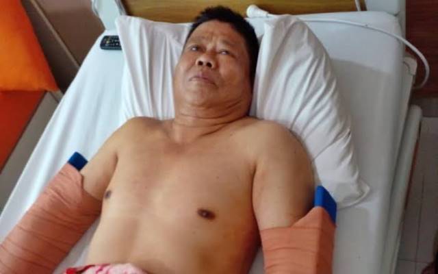 SEMPAT MEMBAIK: Jurkani saat dalam perawatan di RS Ciputra.