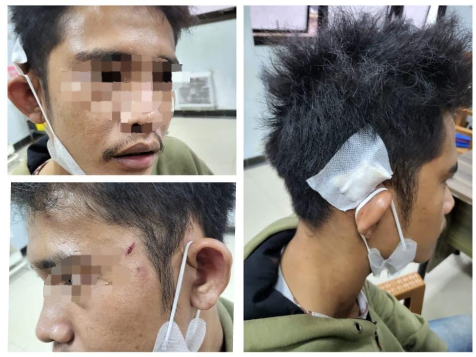 KORBAN: AS, warga Mabuun, Kecamatan Murung Pudak, Kabupaten Tabalong yang menjadi korban pengeroyokan.