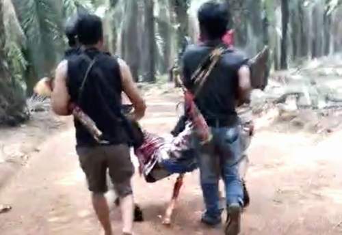 Tangkapan layar salah satu korban yang terluka diduga akibat peluru. (VIDEO IST)