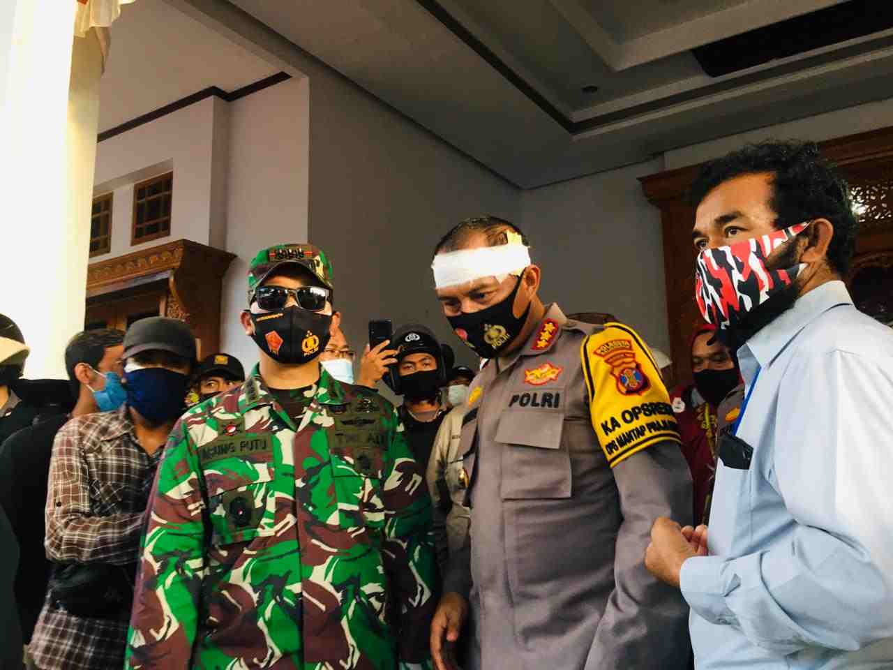 Kepala AKBP Turmudi diperban setelah terkena lemparan dari arah pendemo.