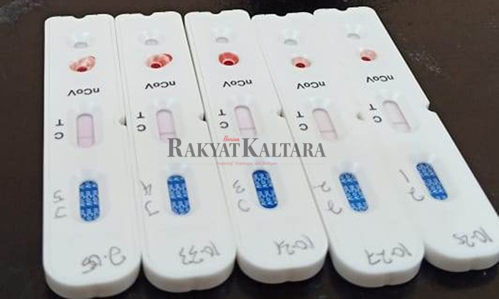 ALAT RDT: Tarakan memberlakukan pembiayaan rapid test Rp 1 juta untuk sekali pemeriksaan.