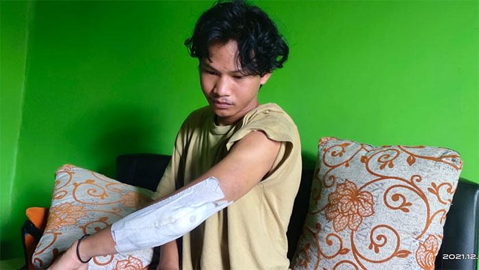 DUGAAN PENGANIAYAAN: Pemuda yang mengalami pengeroyokan yang diduga dilakukan oknum polisi.