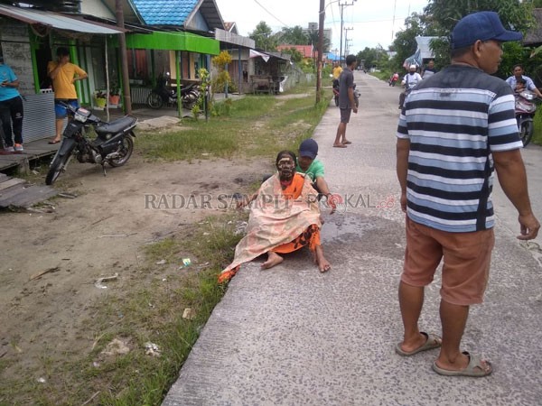 GEGER: Sr (53) mengalami luka bakar setelah sengaja membakar dirinya di Jalan H Muhammad Noor, Kecamatan Mentaya Hilir Selatan, Jumat (19/3).(         KAPOLSEK/RADAR SAMPIT)
