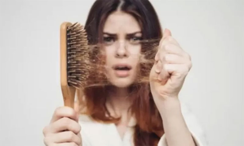 ILUSTRASI: Rambut rontok.