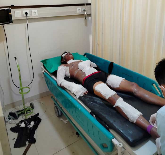 Dua korban bernama Bima Hariadi alias Andi (35)dan Rezi Hafis (21) mengalami luka bakar akibat terbakarnya dapur dan tempat penyimpanan tabung gas LPG dirawat di RS Awal Bros Ujung Batu.