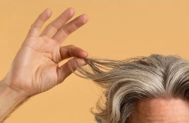 Ilustrasi- Rambut beruban terlalu dini/