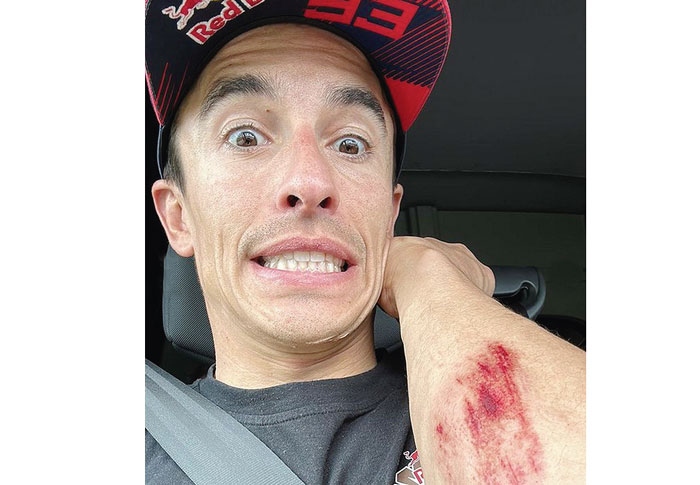Pembalap Gresini Marc Marquez terluka di tangan saat berlatih motocross, kemarin.