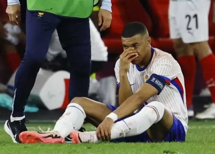 SIAPKAN PELINDUNG: Kylian Mbappe mengalami cedera parah di Euro 2024
