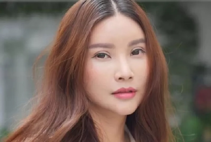 Penampilan Sarwendah usai menjalani operasi plastik di Korea Selatan.