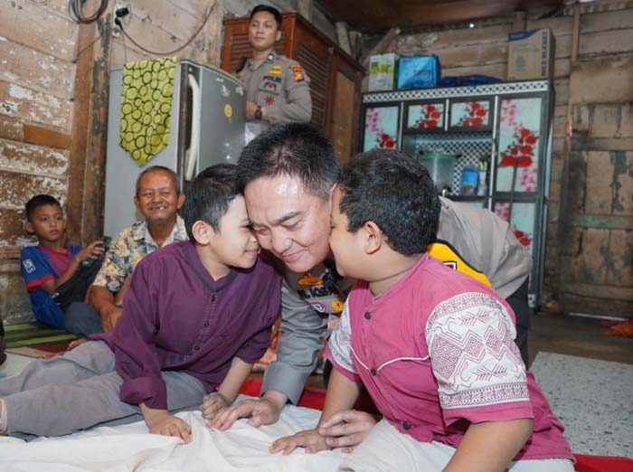 Kapolda Riau Irjen Pol Mohammad Iqbal dicium bocah penderita kelainan genetik tulang Rehan dan Fajri di Pekanbaru, beberapa waktu lalu.