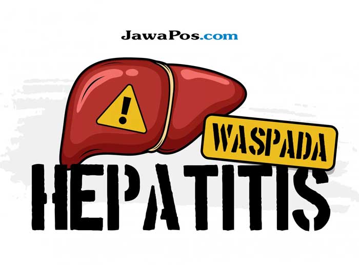 Ilustrasi Hepatitis