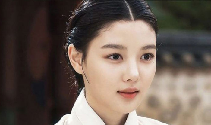 Kim Yoo Jung  dikabarkan bakal menjadi pemeran utama dalam drama mendatang 100 Days of Lies yang disutradarai Yoo In Sik