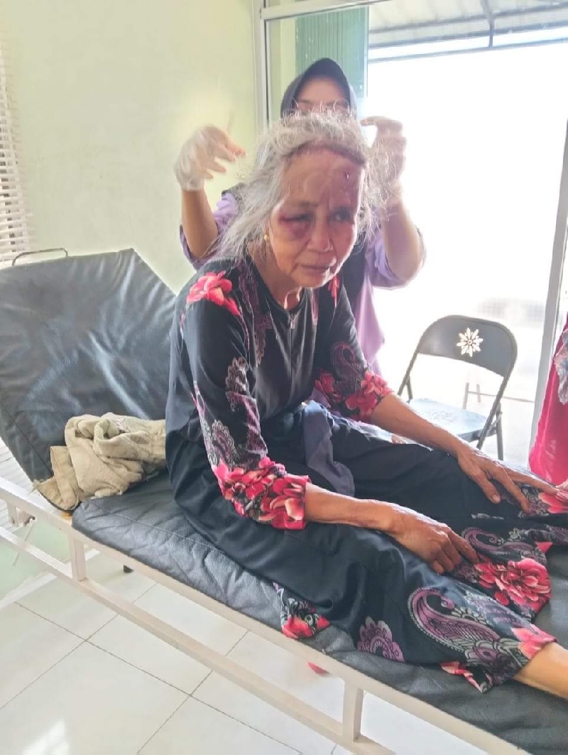 Nurinas (61) korban penganiayaan saat dirawat di Klinik Dokter Herry Barma Kampa, Kabupaten Kampar, belum lama ini.