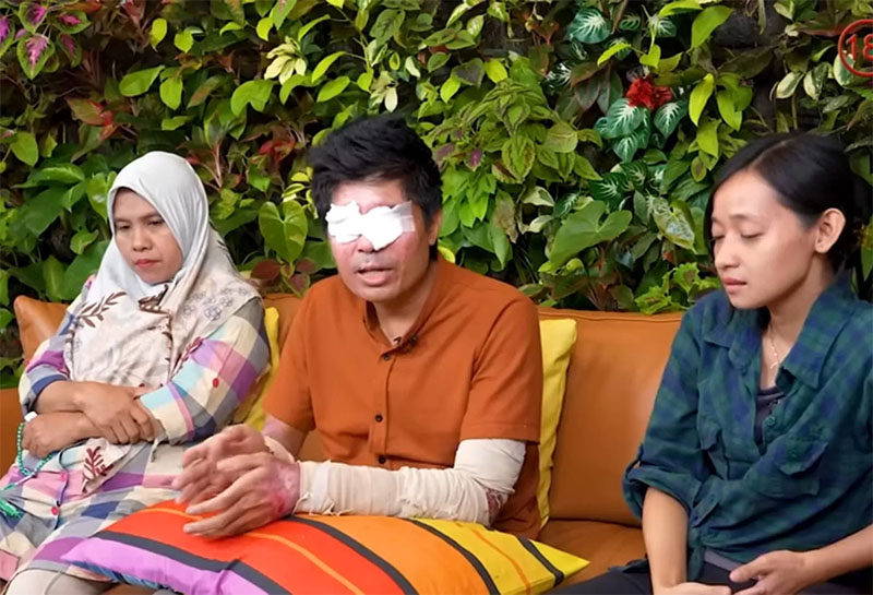 Agus Salim (tengah), korban penyiraman air keras kini bisa melihat lagi.