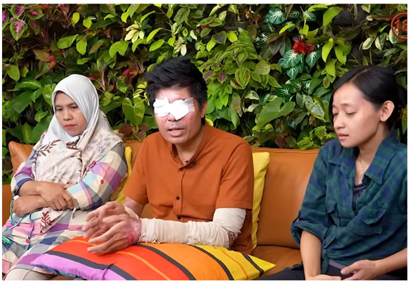 Agus Salim (tengah), korban penyiraman air keras kini bisa melihat lagi.