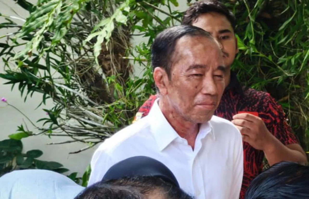 Presiden ke-7 RI Joko Widodo (Jokowi) diduga mengalami alergi kulit.